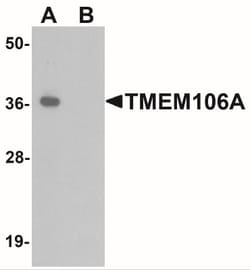 TMEM106A Antibody - BSA Free, Novus Biologicals:Antibodies:Primary Antibodies