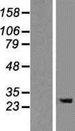 Novus Biologicals&trade;&nbsp;TMEM106B Overexpression Lysate