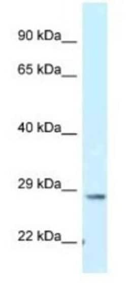 TMEM106B Antibody, Novus Biologicals 100&mu;L; Unlabeled:Antibodies, Polyclonal