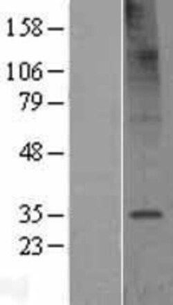 Novus Biologicals&trade;&nbsp;TMEM106C Overexpression Lysate