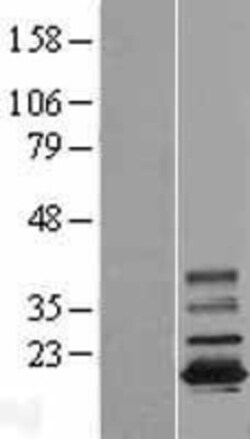 Novus Biologicals™ TMEM11 Overexpression Lysate