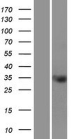 Novus Biologicals TMEM110 Overexpression Lysate 0,1 mg | Buy Online | Novus Biologicals&trade; | Fisher Scientific