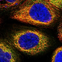 RNF146 Antibody, Novus Biologicals:Antibodies:Primary Antibodies