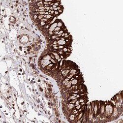 RNF146 Antibody, Novus Biologicals:Antibodies:Primary Antibodies
