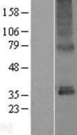 Novus Biologicals&trade;&nbsp;TMEM115 Overexpression Lysate