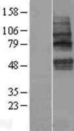 Novus Biologicals&trade;&nbsp;TMEM117 Overexpression Lysate