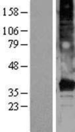 Novus Biologicals™ TMEM120A Overexpression Lysate