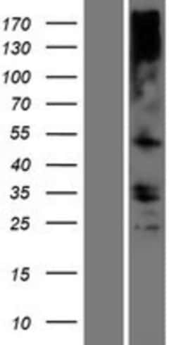 Novus Biologicals&trade;&nbsp;TMEM121 Overexpression Lysate
