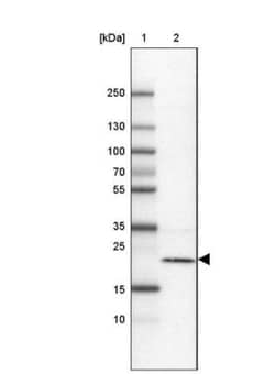 TMEM126B Antibody, Novus Biologicals:Antibodies:Primary Antibodies