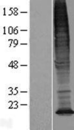 Novus Biologicals™ TMEM128 Overexpression Lysate