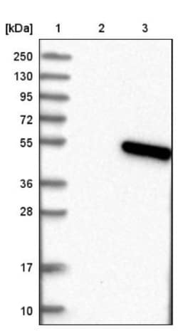 TMEM130 Antibody, Novus Biologicals 0.1mL; Unlabeled:Antibodies, Polyclonal