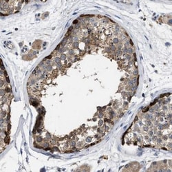 MLF1 Interacting Protein Antibody, Novus Biologicals:Antibodies:Primary