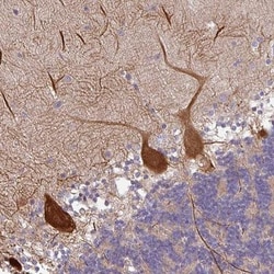 TMEM132A Antibody, Novus Biologicals 25ul | Buy Online | Novus Biologicals | Fisher Scientific