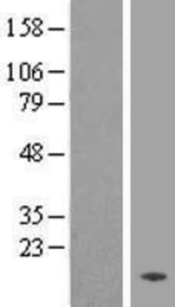 Novus Biologicals&trade;&nbsp;TMEM133 Overexpression Lysate