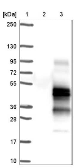 TMEM139 Antibody, Novus Biologicals:Antibodies:Primary Antibodies
