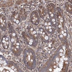 TMEM139 Antibody, Novus Biologicals:Antibodies:Primary Antibodies