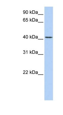 TMEM144 Antibody, Novus Biologicals 100&mu;L; Unlabeled:Antibodies, Polyclonal