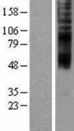 Novus Biologicals&trade;&nbsp;TMEM144 Overexpression Lysate