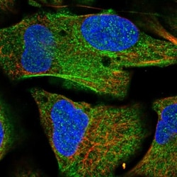 TMEM146 Antibody, Novus Biologicals:Antibodies:Primary Antibodies