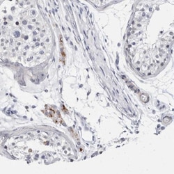 TMEM146 Antibody, Novus Biologicals:Antibodies:Primary Antibodies