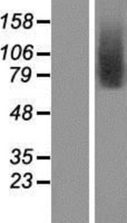 Novus Biologicals&trade;&nbsp;TMEM146 Overexpression Lysate