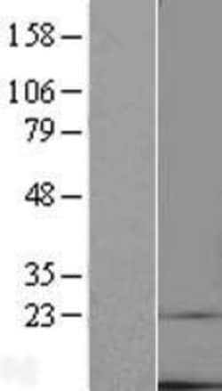Novus Biologicals&trade;&nbsp;TMEM14C Overexpression Lysate
