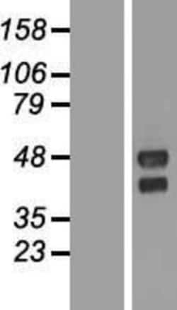 Novus Biologicals&trade;&nbsp;TMEM151A Overexpression Lysate