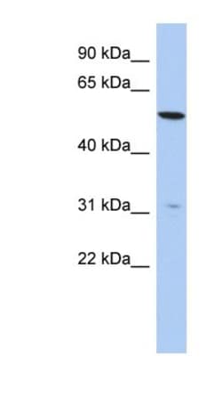 TMEM161B Antibody, Novus Biologicals 100 &mu;L | Buy Online | Novus Biologicals | Fisher Scientific