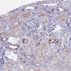 TMEM161B Antibody, Novus Biologicals 0.1mL; Unlabeled:Antibodies, Polyclonal