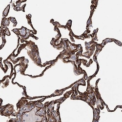 TMEM164 Antibody, Novus Biologicals:Antibodies:Primary Antibodies