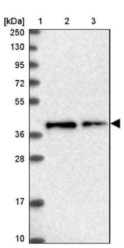TMEM164 Antibody, Novus Biologicals:Antibodies:Primary Antibodies
