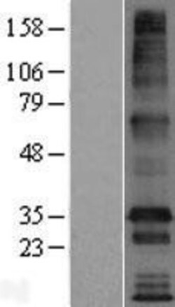 Novus Biologicals&trade;&nbsp;TMEM169 Overexpression Lysate
