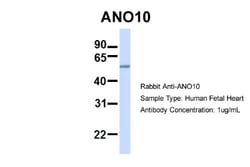 TMEM16K Antibody, Novus Biologicals 100 &mu;L | Buy Online | Novus Biologicals | Fisher Scientific