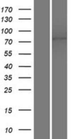 Novus Biologicals™ TMEM16K Overexpression Lysate
