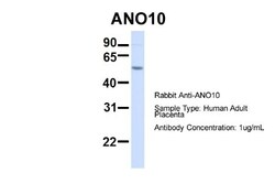 TMEM16K Antibody, Novus Biologicals 100 &mu;L | Buy Online | Novus Biologicals | Fisher Scientific