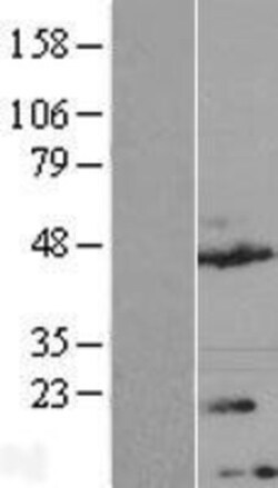Novus Biologicals&trade;&nbsp;TMEM170A Overexpression Lysate