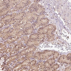 TMEM170B Antibody, Novus Biologicals:Antibodies:Primary Antibodies