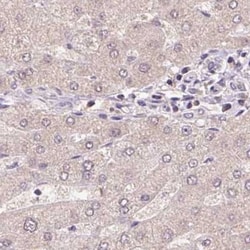 TMEM170B Antibody, Novus Biologicals:Antibodies:Primary Antibodies