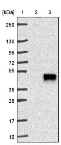 TMEM171 Antibody, Novus Biologicals 0.1mL; Unlabeled:Antibodies, Polyclonal
