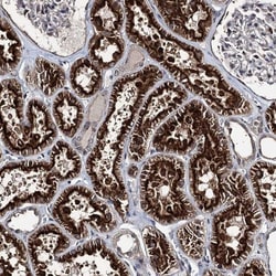TMEM174 Antibody, Novus Biologicals:Antibodies:Primary Antibodies