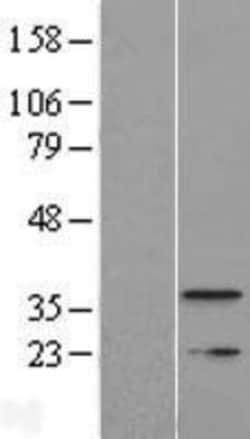 Novus Biologicals&trade;&nbsp;TMEM177 Overexpression Lysate
