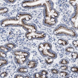 TMEM17 Antibody, Novus Biologicals 0.1 mL | Buy Online | Novus Biologicals | Fisher Scientific