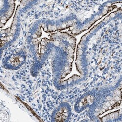 TMEM180 Antibody, Novus Biologicals 0.1mL; Unlabeled:Antibodies, Polyclonal