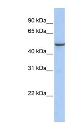 TMEM184A Antibody, Novus Biologicals 100&mu;L; Unlabeled:Antibodies, Polyclonal