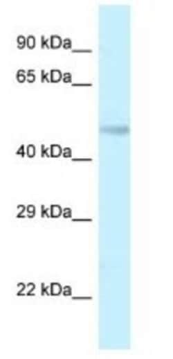 TMEM184B Antibody, Novus Biologicals:Antibodies:Primary Antibodies