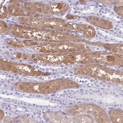 TMEM185A Antibody, Novus Biologicals:Antibodies:Primary Antibodies