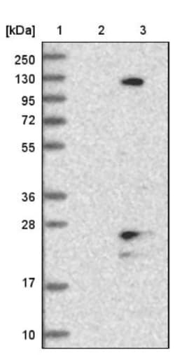 TMEM186 Antibody, Novus Biologicals 0.1mL; Unlabeled:Antibodies, Polyclonal