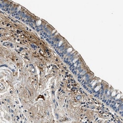 TMEM186 Antibody, Novus Biologicals 0.1mL; Unlabeled:Antibodies, Polyclonal