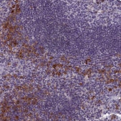 TMEM188 Antibody, Novus Biologicals 25 &mu;L; Unlabeled:Antibodies, Polyclonal