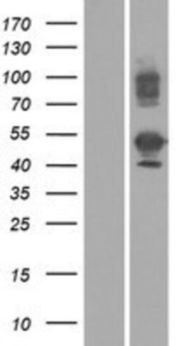 Novus Biologicals&trade;&nbsp;Kua-UEV Overexpression Lysate
